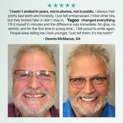 "🎁Ends Today: 70% OFF! ⏰kleanam™ Medical Full Denture with Strong Suctiond🦷Obtain American Dental Association (ADA) Certification