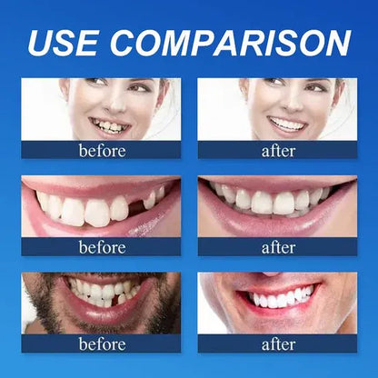 "🎁Ends Today: 70% OFF! ⏰kleanam™ Medical Full Denture with Strong Suctiond🦷Obtain American Dental Association (ADA) Certification